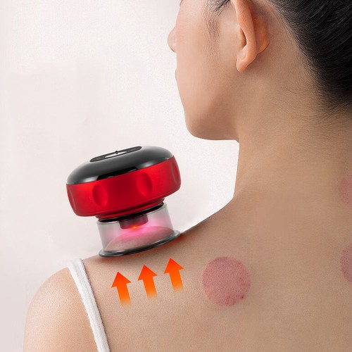 Elektro massageger schr pfen - massageger?t, schr?pfen